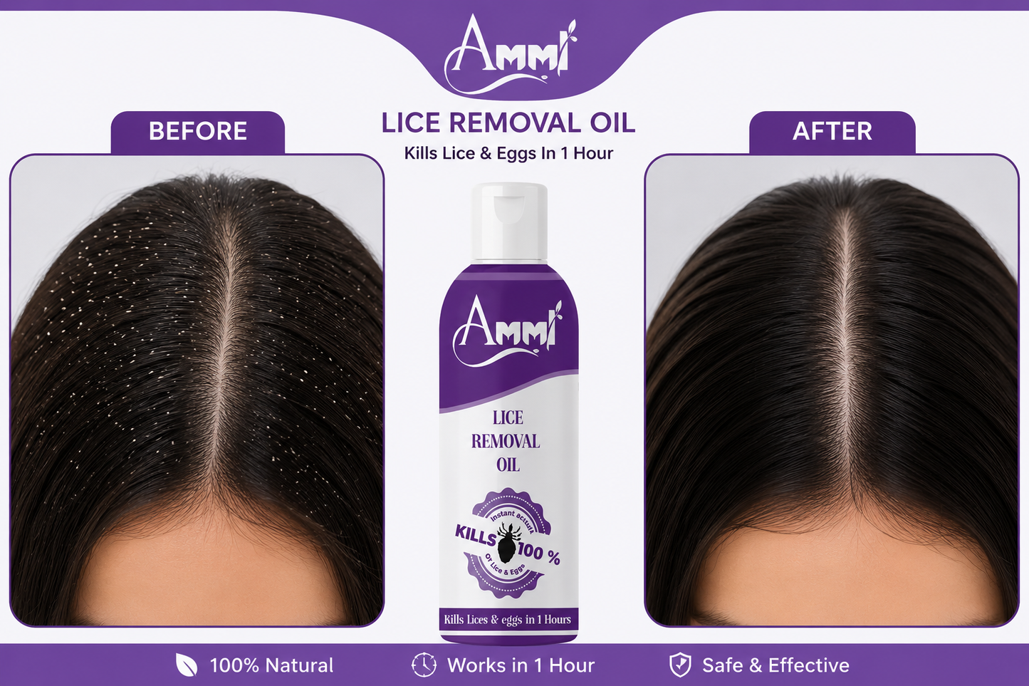 Lice Away Botanical Hair Oil 100ml | Anti Lice Treatment for Men, Women & Kids (5+ Years)