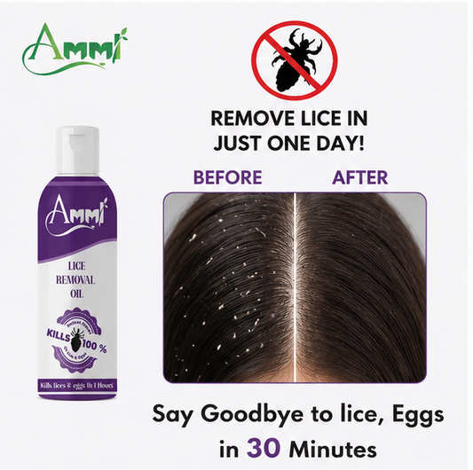 Lice Away Botanical Hair Oil 100ml | Anti Lice Treatment for Men, Women & Kids (5+ Years)