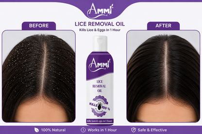 Lice Away Botanical Hair Oil 100ml | Anti Lice Treatment for Men, Women & Kids (5+ Years)